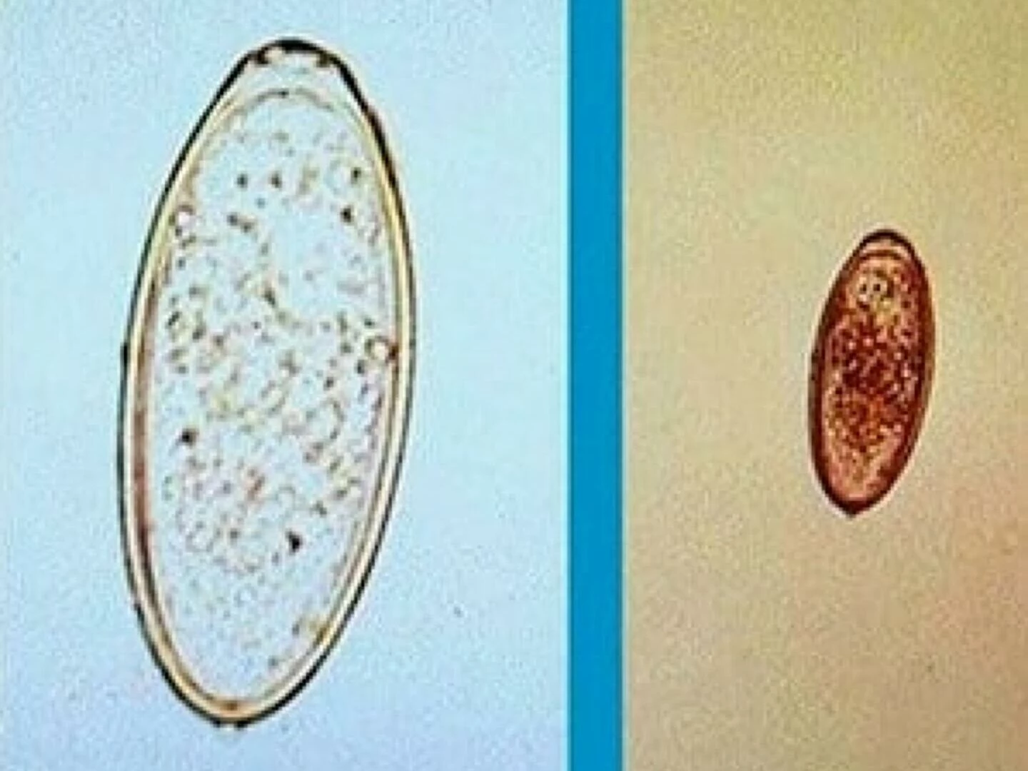 pin worm test
